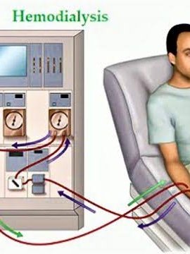 Haemo-dialysis (by Gambro Dialysis Machine and Water Treatment Plant from Sweden)