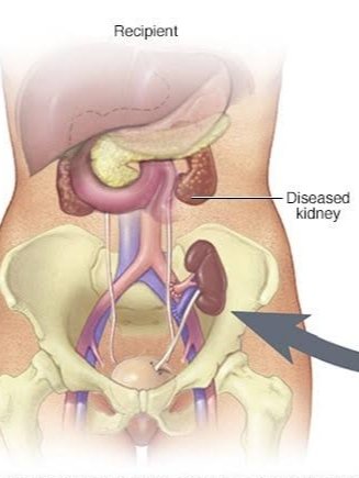 Per-transplant Work-up